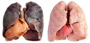 plămânii fumătorului și sănătoși